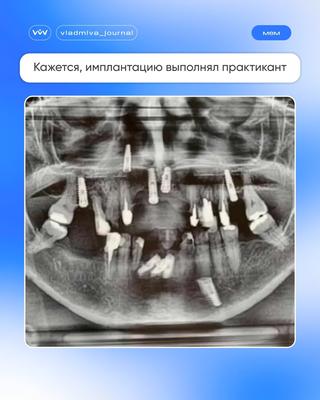 Первый шаг к идеальной улыбке — с нас.